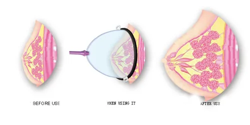 UHF Firming Breast Stimulator Medical Polymer Safe — How to Use for Optimal Results