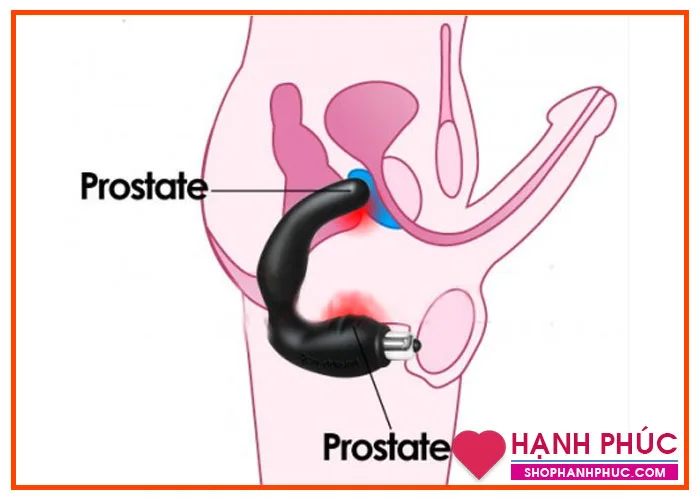 Fabu Aubrey Prostate Massager Erotic Couple Sex Toy — Premium Features and Specifications