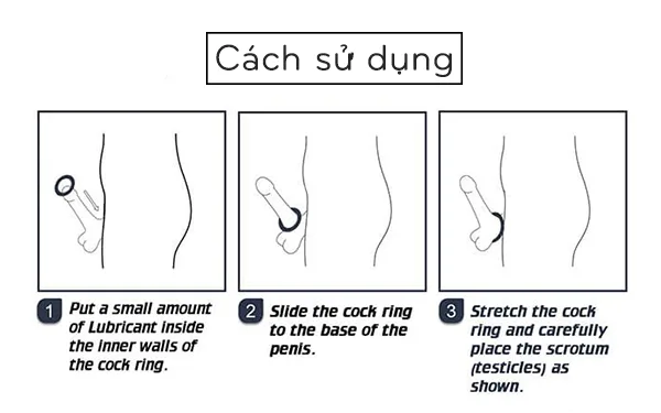 Elephant Rings Set 3 Penis Delay Enhancer Cock Rings — Why Choose Elephant Rings?